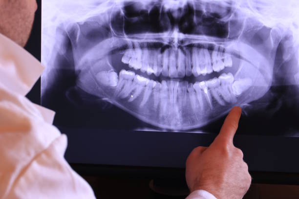 Best Emergency Dentist for Special Needs Patients in Tremont, IL
